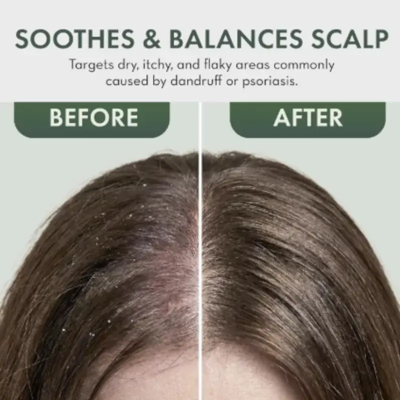 Anti Dandruff Oil 200ml - photo 4
