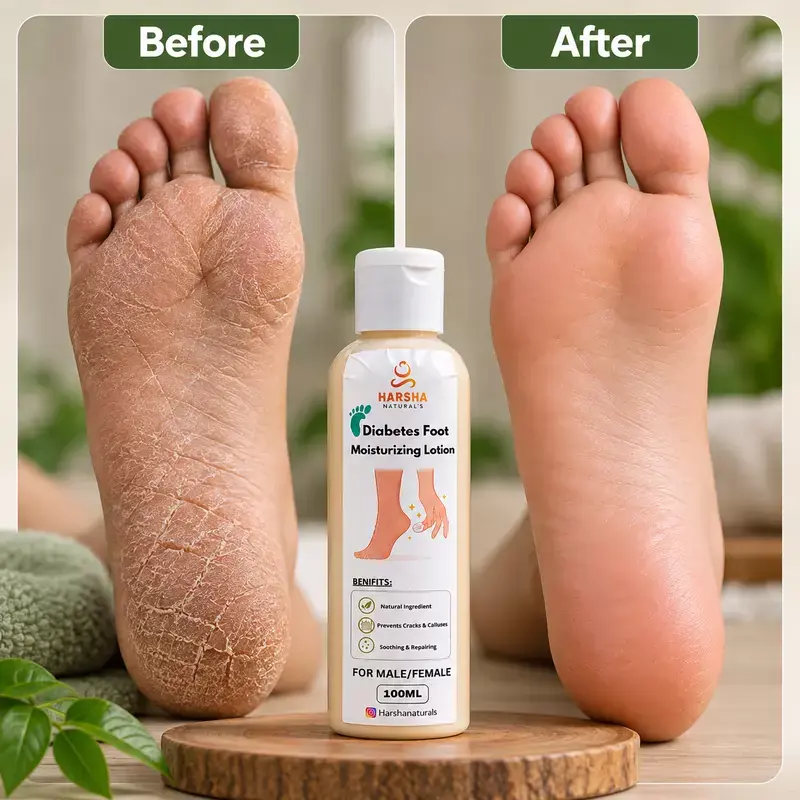 Diabetes Foot Moisturizing Lotion - photo 4