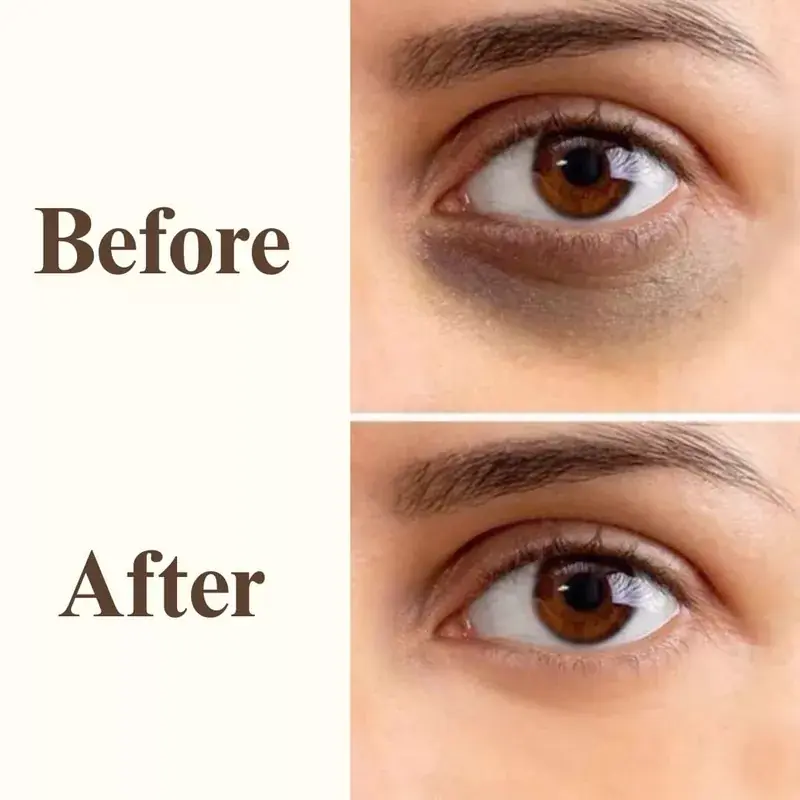 Under Eye Glow Gel - photo 6